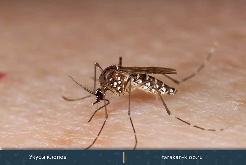 Как отличить от комара